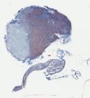 Pituitary-glandX