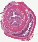 StomachX