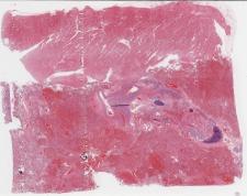 H1N1-53-001.dzi