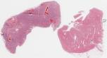 H1N1-53-003.dzi