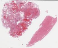 H1N1-53-004.dzi