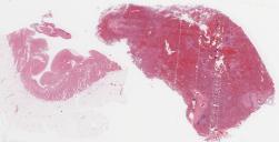H1N1-53-005.dzi