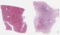 H1N1-53-006.dzi