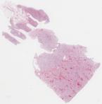 H1N1-53-007.dzi