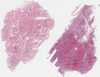 H1N1-53-009.dzi