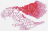 H1N1-53-011.dzi